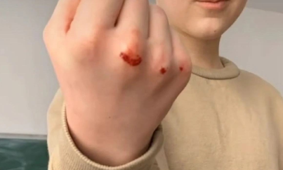 De ce sunt atrași copiii de jocurile teribiliste de pe TikTok. Provocarea populară care le provoacă răni și vânătăi De ce sunt atrași copiii de jocurile teribiliste de pe TikTok. Provocarea populară care le provoacă răni și vânătăi